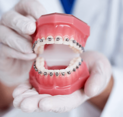 Dentist holding a dental model demonstrating braces at Enamel Elegance